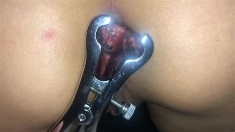 Doctor In The House Examining This Tight Asshole With Fingers And Anal