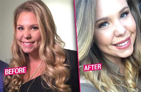 kailyn lowry takes another trip to the plastic surgeon s office after