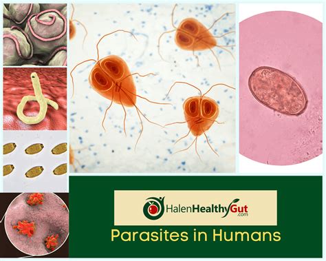 parasite cleanse diet  humans   natural remedies