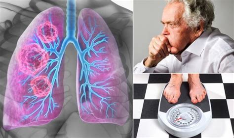 lung cancer symptoms the 12 most common warning signs of a tumour