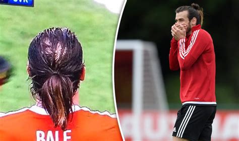 euro 2016 wales gareth bale hair loss reveals shocking bald patch