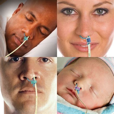 amt bridle family nasal tube retaining systems nasal bridle