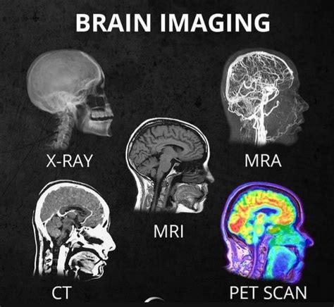 Brain Imaging Coolguides