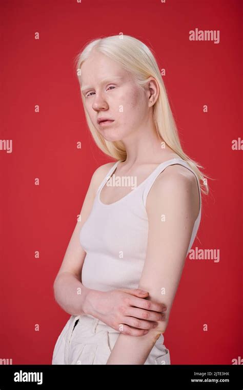 Portrait Of Albino Girl With Unusual Appearance Posing Against Red