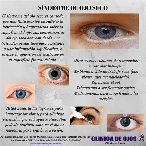 clínica de ojos oftalmic láser sÍndrome de ojo seco sindrome de ojo