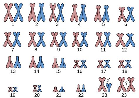 Síndrome De Down O Trisomía Del Cromosoma 21 Reproducción Asistida