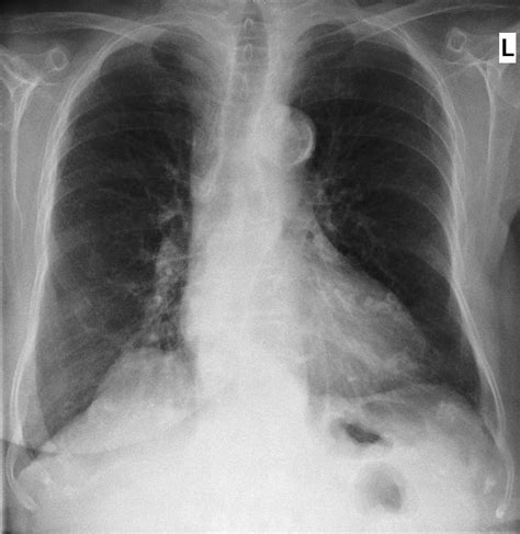 thorax diagnostik