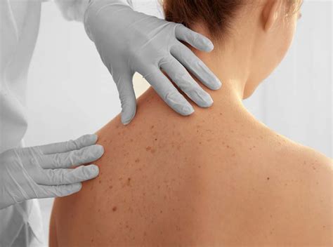 skin examinations philadelphia pa dermatology