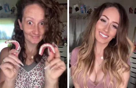 Woman Who Lost Teeth During Pregnancy Shows Off Incredible