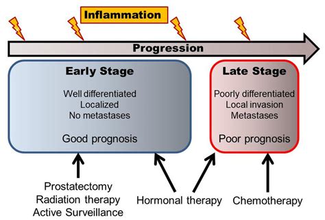 the scheme of different stages and progression of prostate
