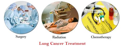 lung cancer diagnosis and treatment lung cancer diagnosis staging