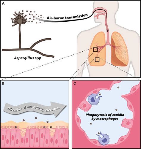 frontiers  advances  fungal infections  lung ecology