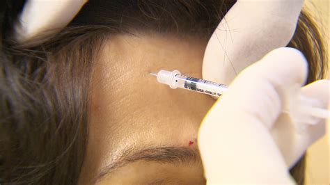 depressed botox just might help you feel better