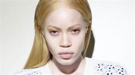 albino models black women hairstyles hairstyles  hair colors  haircuts