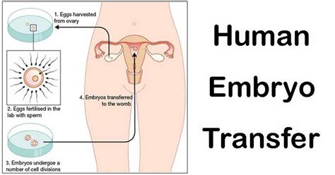 human embryo transfer conditions types procedure