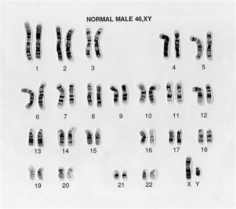 Normal Male 46 Xy Human Karyotype Wellcome Collection