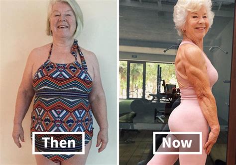 Before And After Pics Of A 73 Year Old Mom Who Lost Over 50 Pounds With