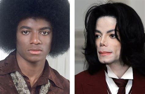 13 Most Expensive Celebrity Plastic Surgeries Michael Jackson