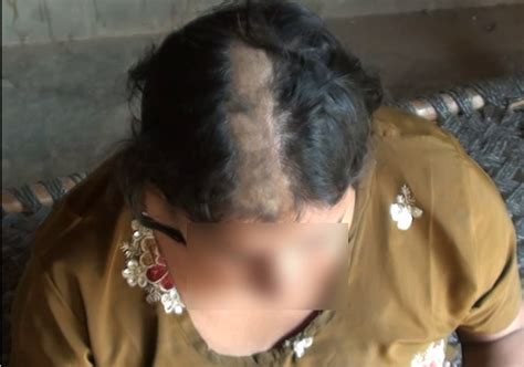 woman tonsured by neighbours in aligarh on suspicion of