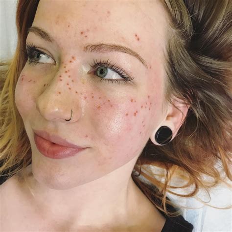 Tattoo Artist Creates Freckles In The Shape Of Astrological Signs