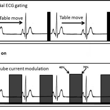 model shows ecg gating  pga  etctm  prospective axial ecg  scientific diagram