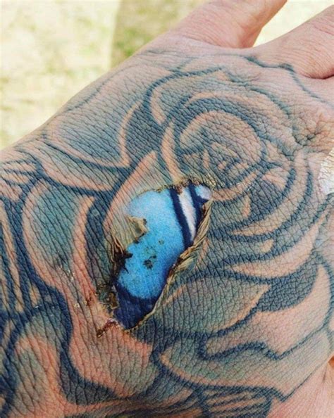 Reddit Users Are At Each Others Throats Over This Burnt Tattoo Photo