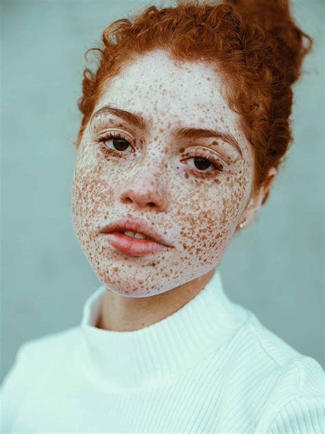 photographer captures  beauty  freckles    glory