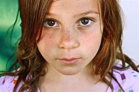 Girl Teen Freckles Freckles At Brdteengal