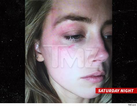 Amber Heard Claims Domestic Violence Seeks Restraining