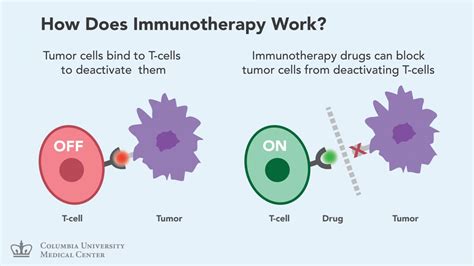 Immunotherapy New Hope For Patients With Advanced Lung Cancer