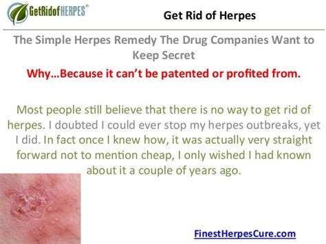 herpes simplex 1