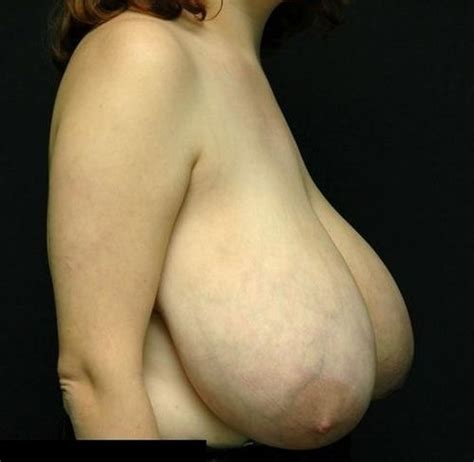 huge veiny saggy breasts