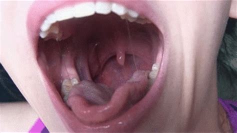 Uvulva Focus Coughing Gagging And Wide Open Mouth View Lacies