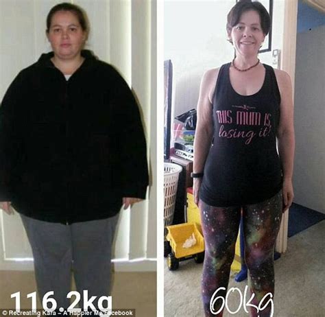 Incredible Weight Loss After Lap Band Surgery Leaves Victorian Mother