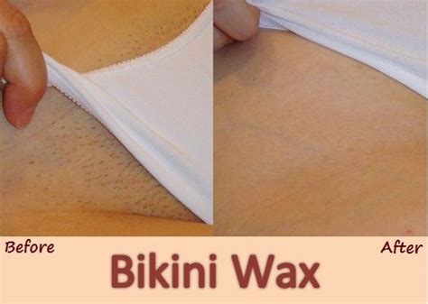 Brazilian Wax Before And After Photos