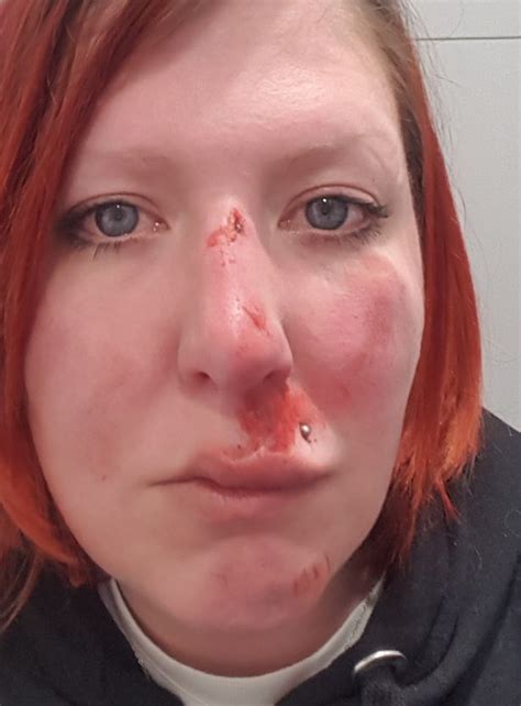 mum on charity sleep out attacked after she refused to
