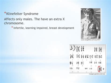 Ppt Genetic Disorders Powerpoint Presentation Free Download Id 2075339