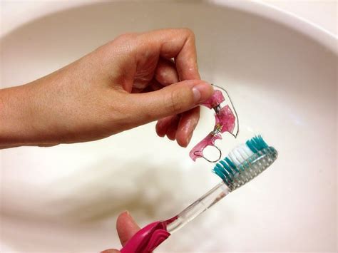 midvale orthodontist offers expert advice  cleaning  retainers