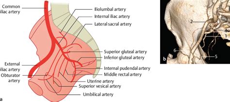 internal iliac artery radiology key