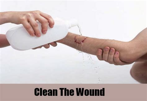 home remedies  wounds search home remedy