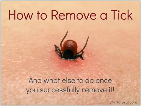 remove  tick      youve  bitten