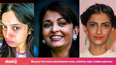 5 Bollywood Actresses With Bad Skin Truth Beneath Makeup Layers