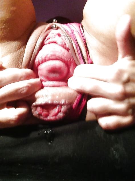 broken vagina totally overstretched 28 pics