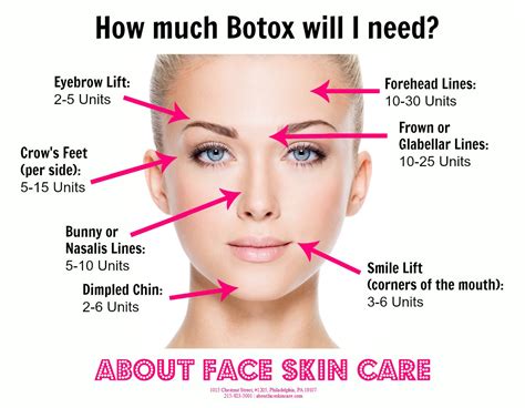 botox treatment everything what you expect common