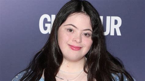 Down S Syndrome Vogue And Barbie Model Ellie Goldstein Lives Her Dream