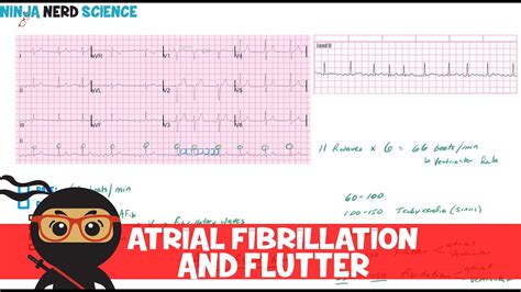 Atrial Flutter Vs Atrial Fibrillation Hournored