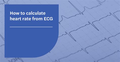 How To Calculate Heart Rate From Ecg Seer Medical Au