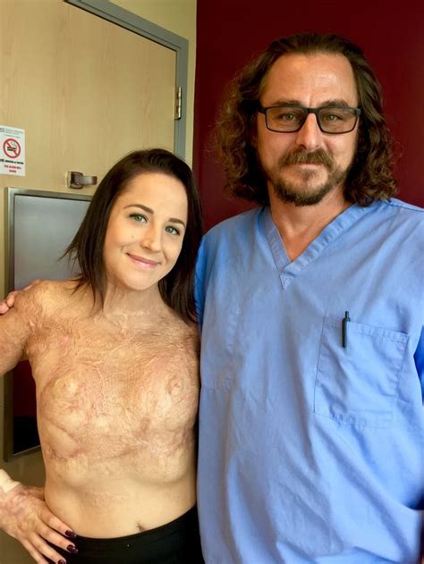 brave woman bares her scars after setting herself on fire when she discovered she was sexually