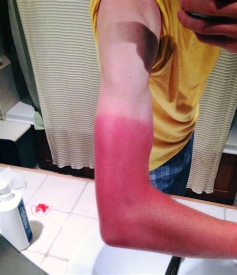 For The Last Time People Use Sunscreen