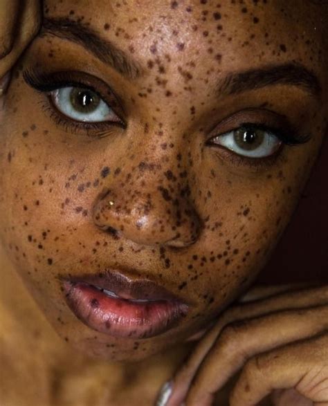 99 Tumblr Freckles On Dark Skin Black People With Freckles Women